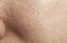 Detail pleti