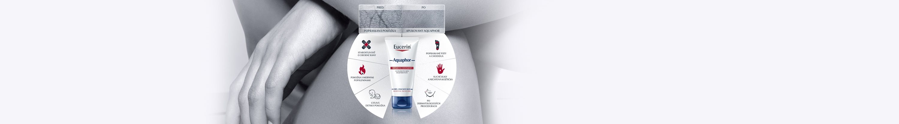 Aquaphor ointment for damaged skin