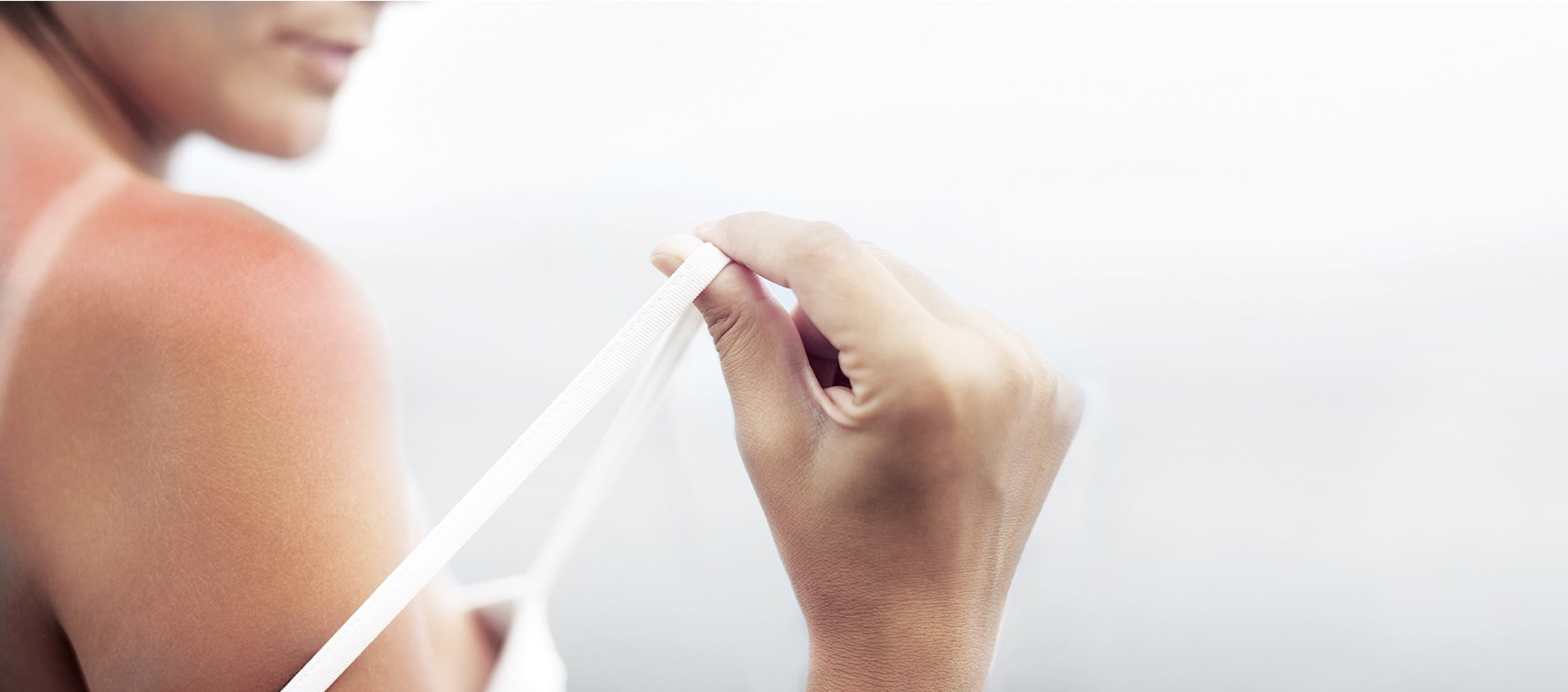 Starostlivosť o drobné popáleniny